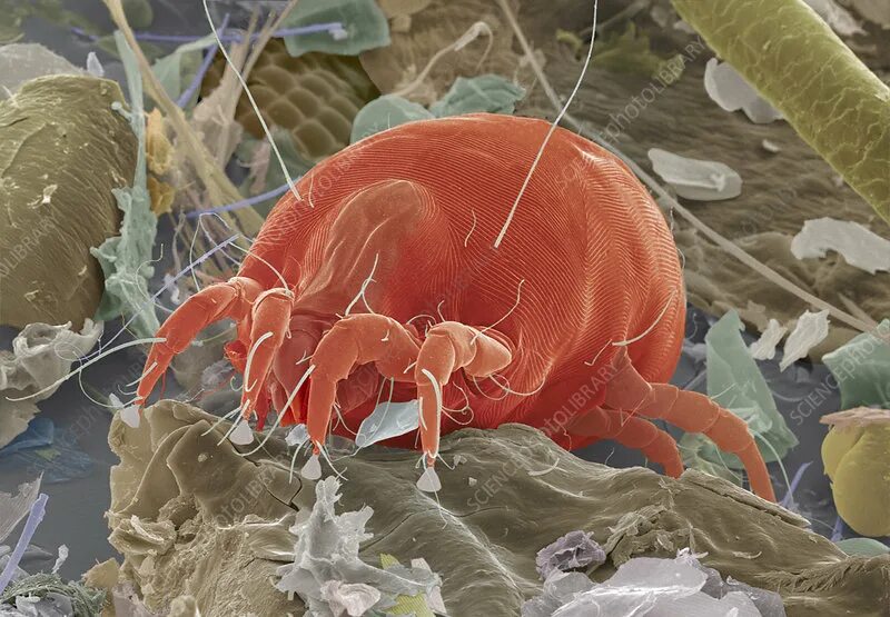 Постельные пылевые клещи фото Dust mite, SEM - Stock Image - Z445/0326 - Science Photo Library