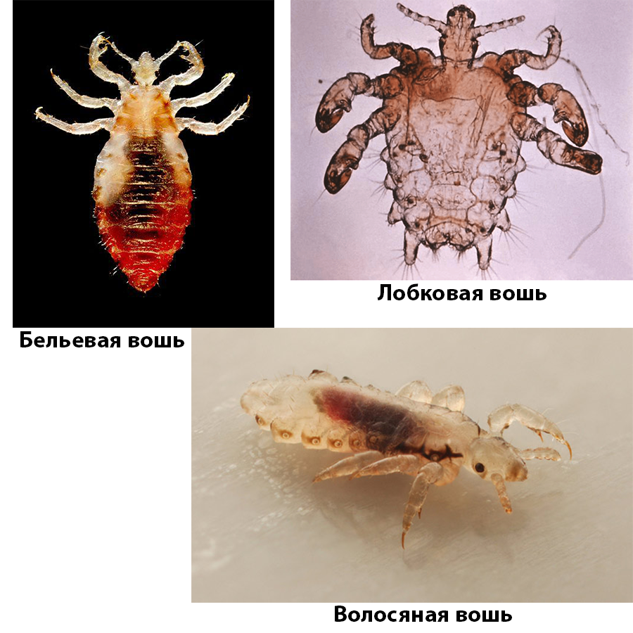 Постельные вши укусы фото Вша глагол