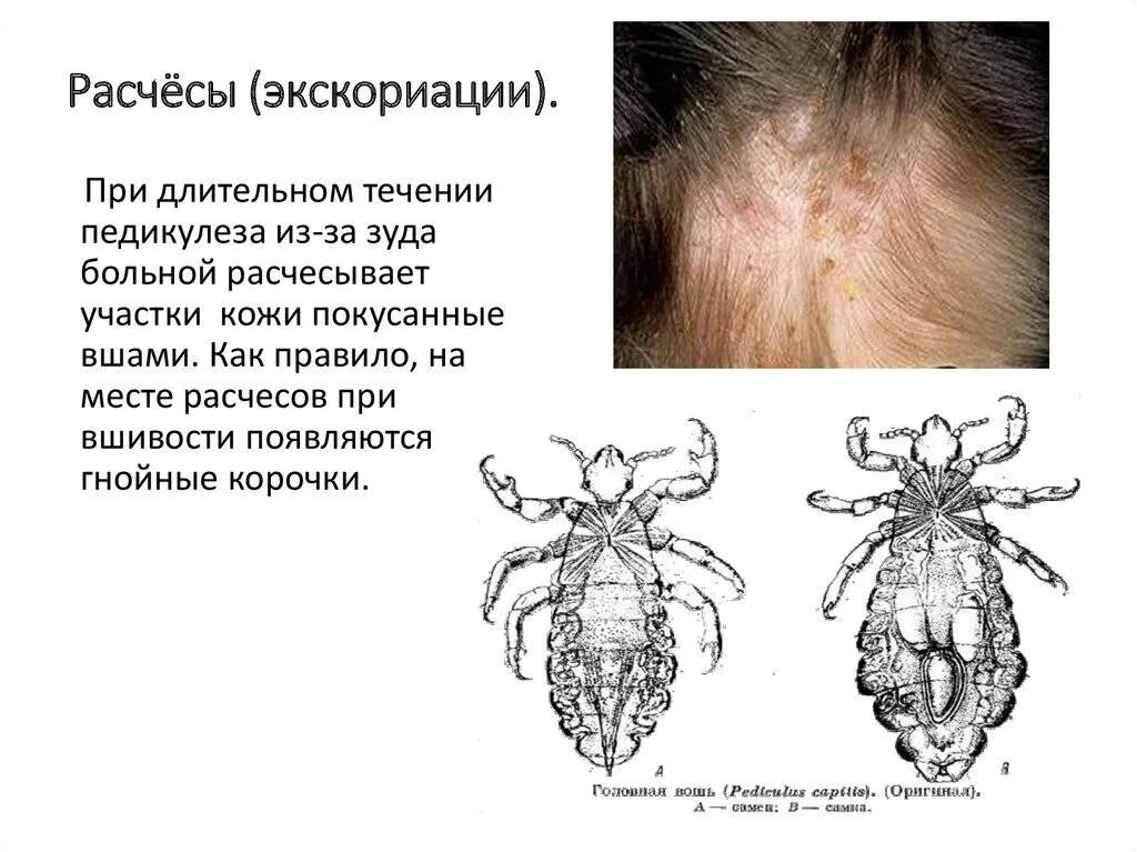 Постельные вши укусы как выглядят на теле Вши чесотка