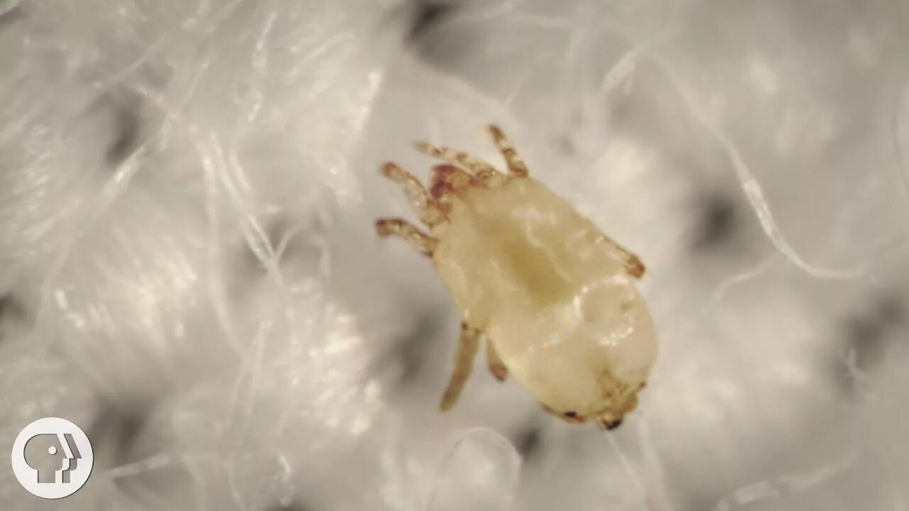 Постельный клещ аллергия фото Meet the Dust Mites, Tiny Roommates That Feast On Your Skin Deep Look - YouTube