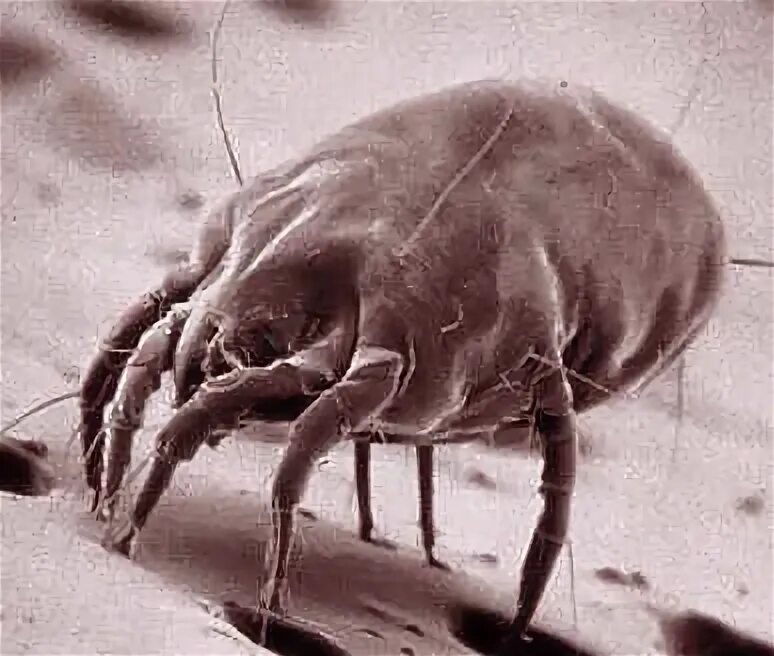 Постельный клещ под микроскопом фото Dust mite allergies in the house