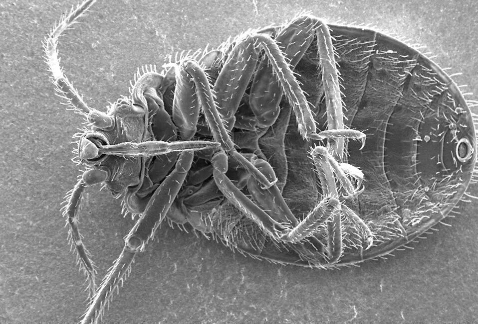 Постельный клещ под микроскопом фото Bedbug Free Stock Photo Microscopic bedbug scanning electron micrograph. 16709