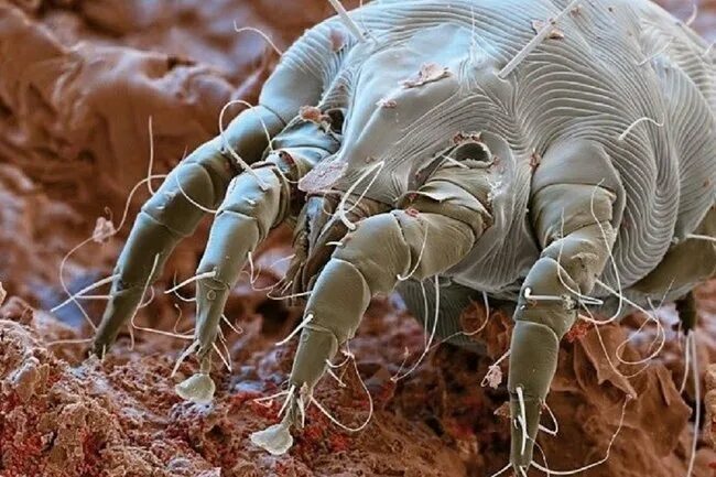 Dust Mite Bites: Treatment, Symptoms, and More