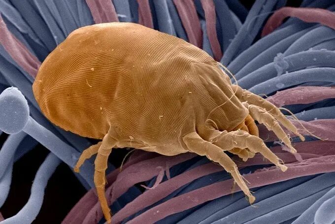 Постельный клещ под микроскопом фото 7 Ways to get rid of dust mite allergy Dust mite allergy, Dust allergy, Allergie