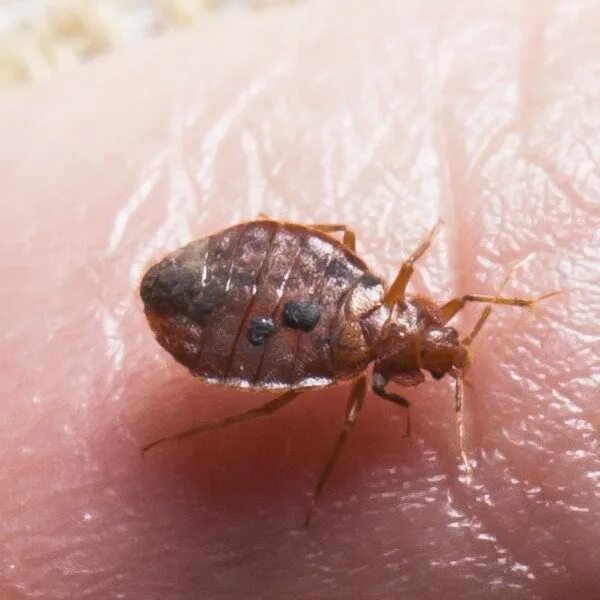 Постельный клоп фото укусов на теле ребенка Bed Bugs: Get Rid of Your Bed Bugs Instantly & Long Term Bed bugs, Bed bug facts