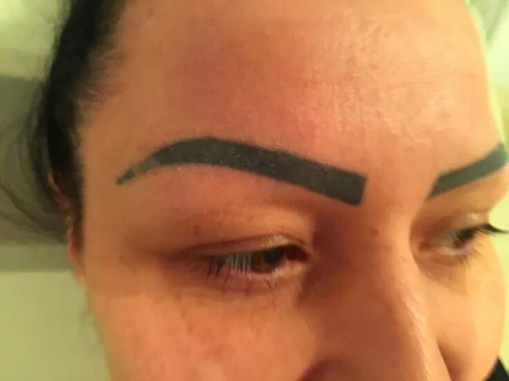 Повторный татуаж Head Tattoo Removal Unique Eyebrow Tattoo Removal Near Me Head tattoos, Tattoo r