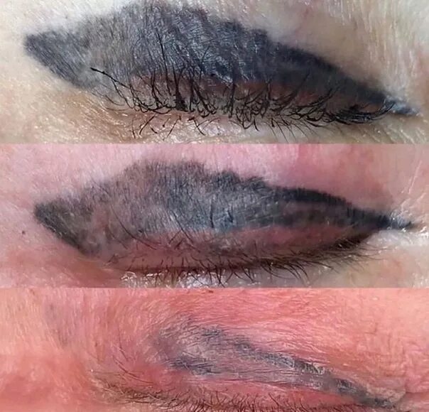 Повторный татуаж Фотографии на стене сообщества - Фотография 1 из 35 ВКонтакте