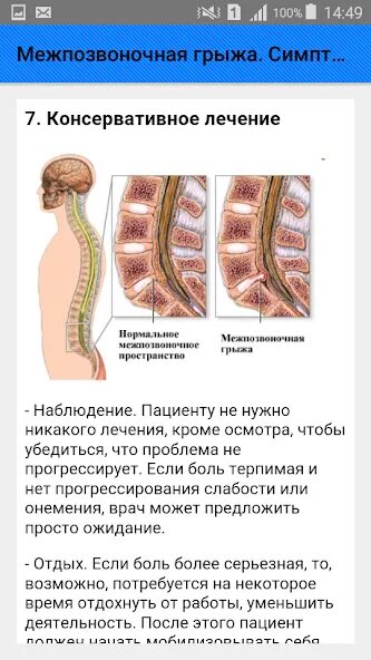 Поясничная грыжа симптомы у мужчин фото Межпозвоночная грыжа. Симптомы - אפליקציות ב-Google Play