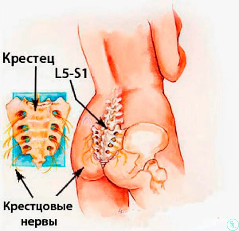 Пояснично крестцовый отдел фото Межпозвоночный диск человека - анатомия, строения