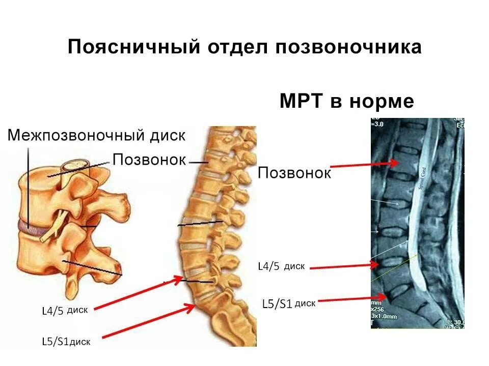 Пояснично крестцовый отдел фото Где сделать МРТ пояснично-крестцового отдела позвоночника в Москве?