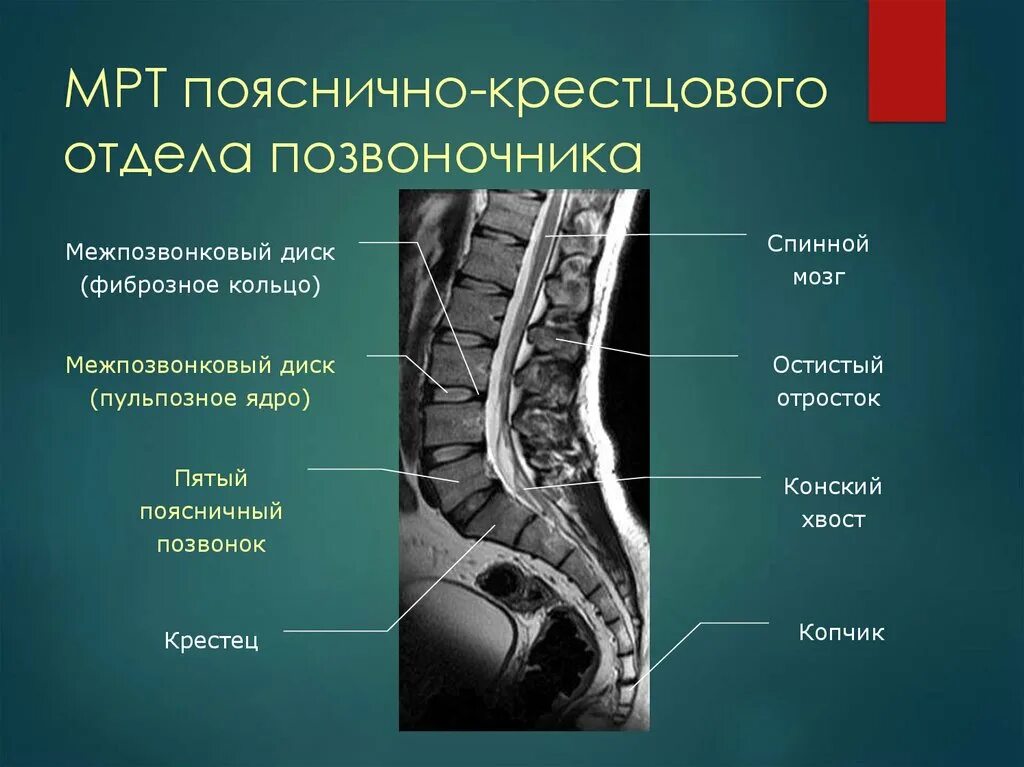 Пояснично крестцовый отдел фото Где находится пояснично крестцовый отдел фото: найдено 86 изображений