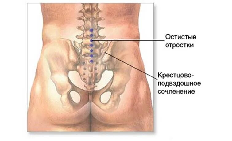 Пояснично крестцовый отдел фото на человеке У меня часто бывает боль в крестце: почему это происходит и можно ли вылечить до