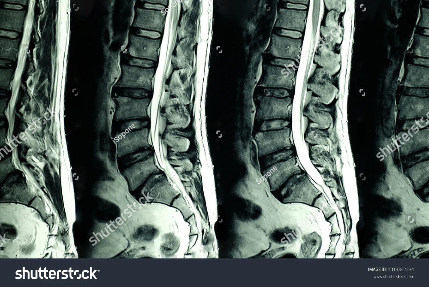 Поясничный отдел фото Scan mri: Lebih dari 19.116 Foto Stok yang Dapat Dibeli Lisensinya Tanpa Royalti