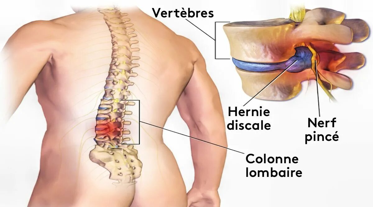 Поясничный отдел фото Épinglé sur Bien être et santé