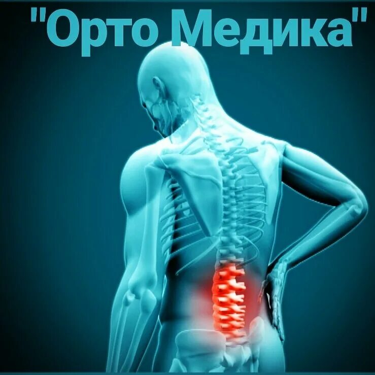 Поясничный отдел фото Permanently closed: Orto Medica, orthopedic shop, Voronezh, ulitsa Uritskogo, 12