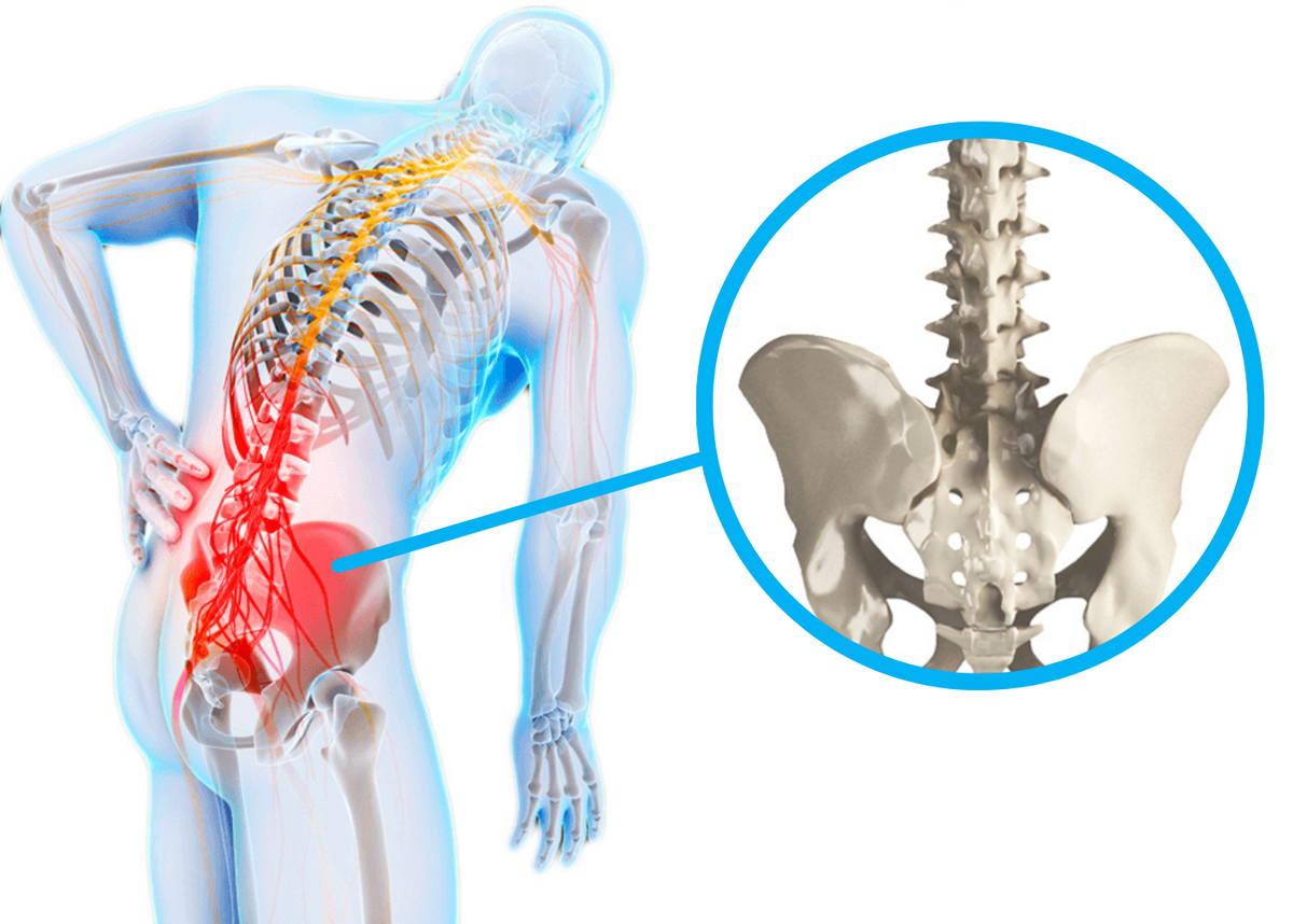 Поясничный отдел женщин фото Сакроилеит: подвздошная опасность. Cordus - персональная медицина Дзен