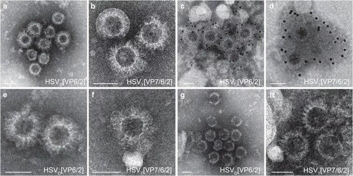 Поясной герпес фото Electron micrographs of herpes simplex virus type 1 (HSV-1) amplicon... Download