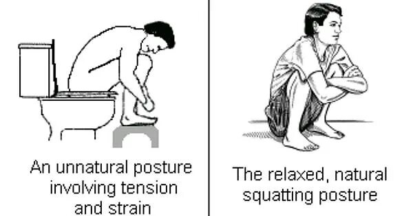 Поза орла при дефекации фото The Fecal Position. - Imgur