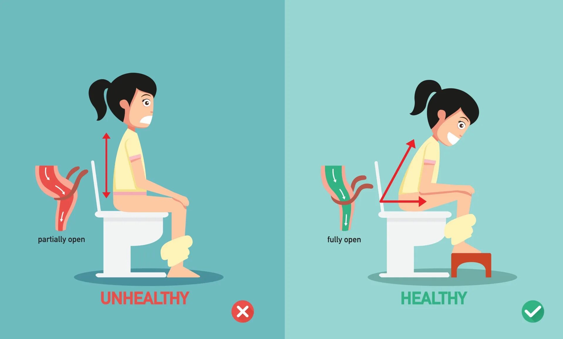 Поза орла при дефекации фото unhealthy vs healthy positions for defecate illustration, vector 2894592 Vector 