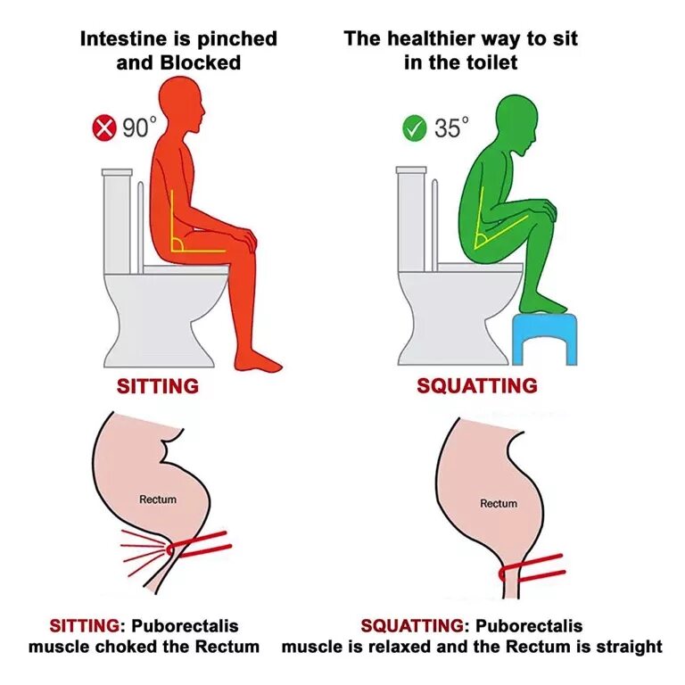 Поза орла при дефекации фото Constipation & Your Pelvic Floor: Position Matters! - MOTI Physiotherapy, bowel 