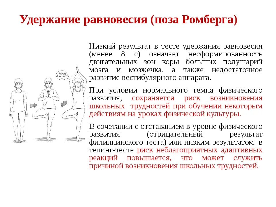 Поза ромберга что это такое фото Нарушение динамического равновесия: найдено 90 изображений