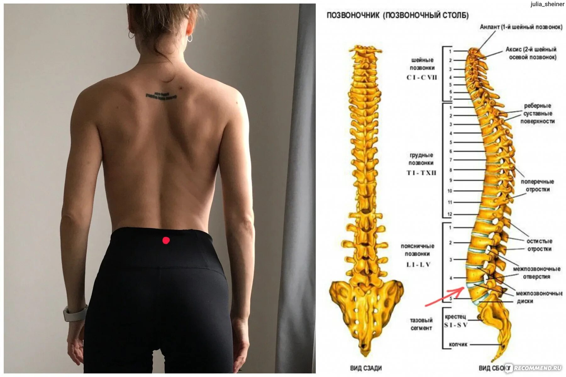 Позвонки по номерам на фото человека УЗИ поясничного отдела позвоночника - "УЗИ поясничного отдела позвоночника показ