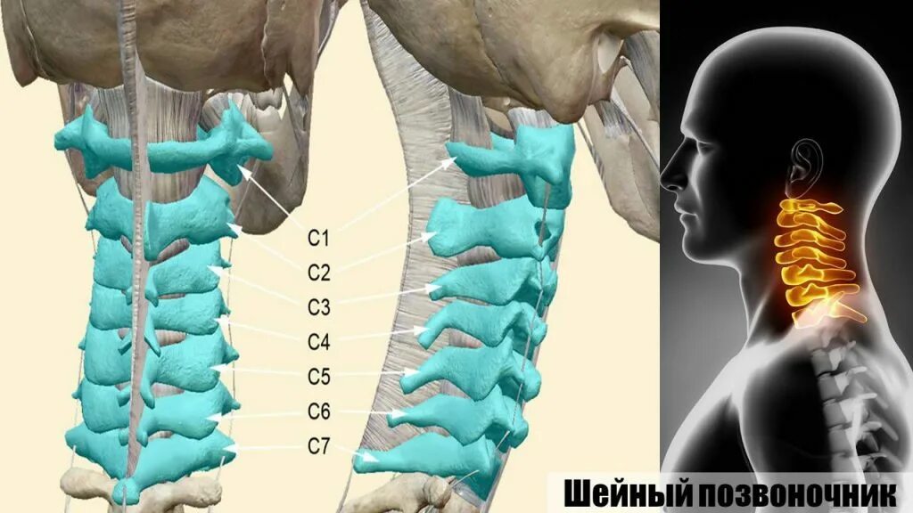 Позвонки шейного отдела фото Грыжа шейного отдела позвоночника симптомы, лечение без операции в Москве