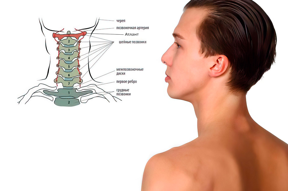 Позвонки шейного отдела фото Коррекция Атланта в Дзержинске