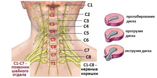 Позвонки шейного отдела по номерам на фото Лечение остеохондроза шейного отдела позвоночника в домашних условиях. Как лечит
