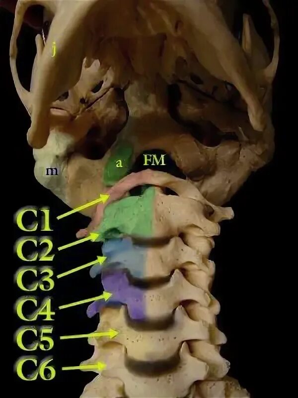 Позвонки шейного отдела позвоночника фото Pin em spinal