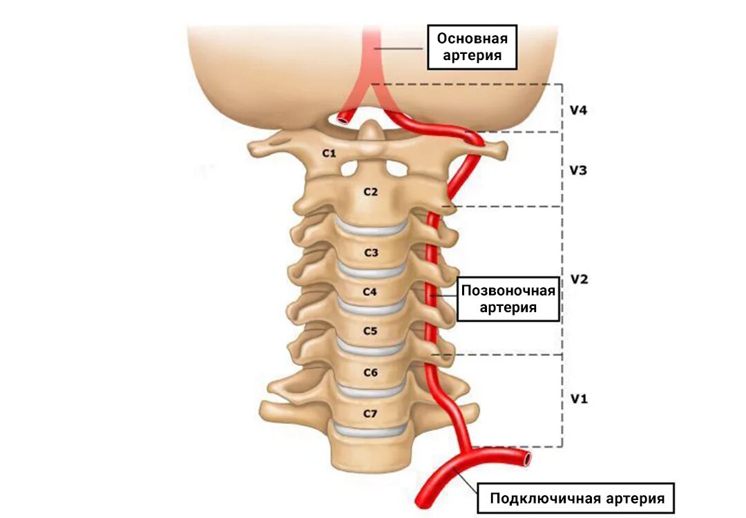 Позвоночная артерия анатомия схема расположения Вертебро-базилярная недостаточность - болезнь программиста с тысячью лиц / Habr