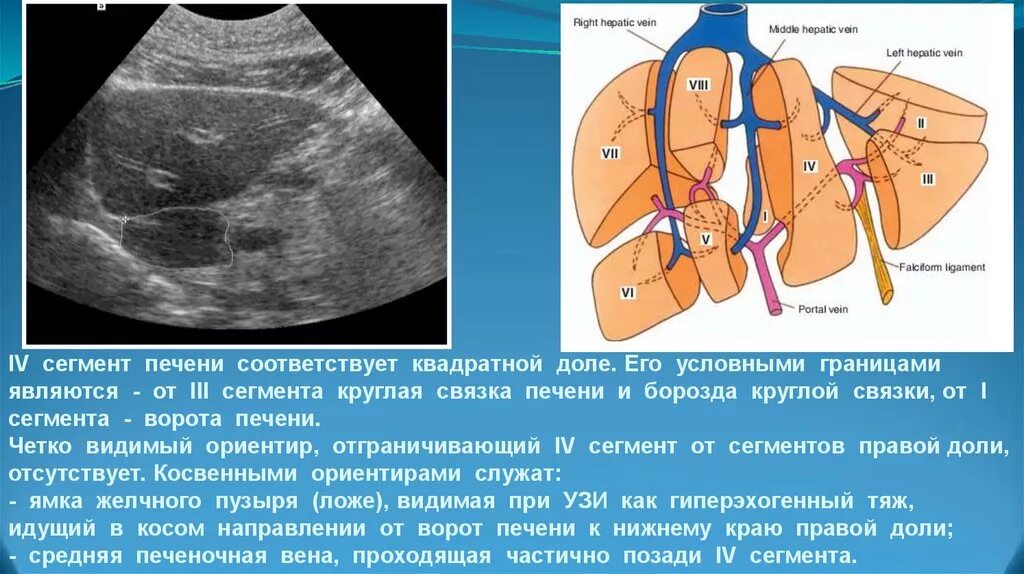 Правая доля печени фото Схема сегментов печени на узи