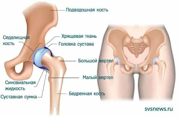 Правая подвздошная кость у человека фото Рисунок сустава тазобедренного сустава