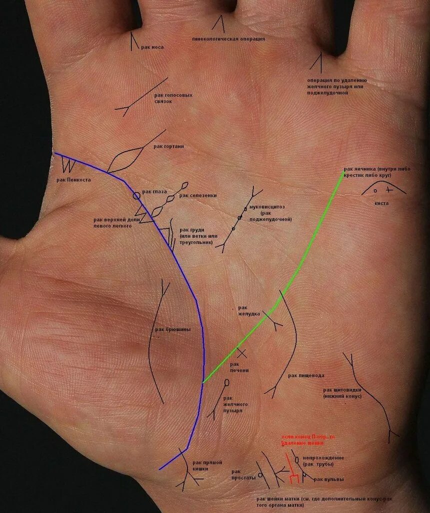 Правая рука линии на ладони фото ВОПРОСЫ о Знаках и Линиях на Ваших Руках (ПРОЧТИТЕ ПЕРВОЕ СООБЩЕНИЕ ТЕМЫ, несоот