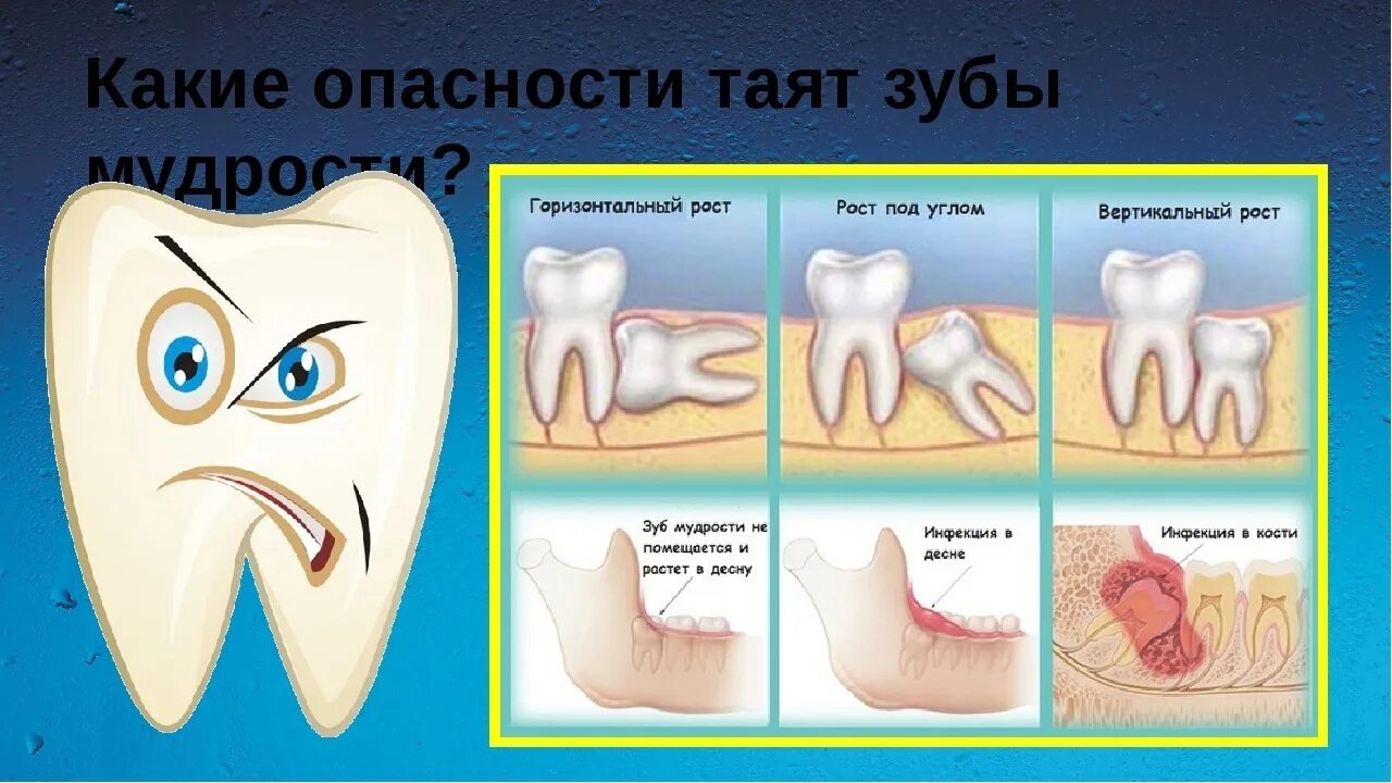 Правильный зуб мудрости фото Чем отличается зуб мудрости