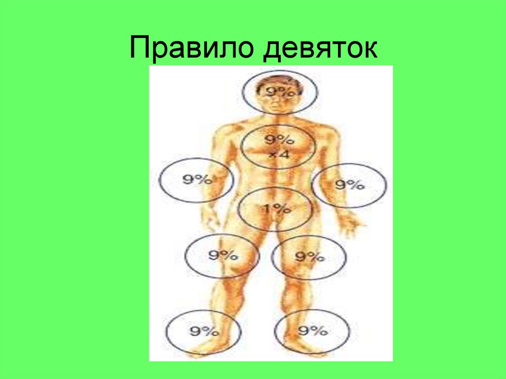 Правило 9 фото Термическая травма. Ожоги. Отморожения - презентация онлайн