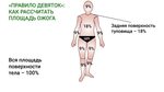 Правило 9 фото Площадь ожога правило 9