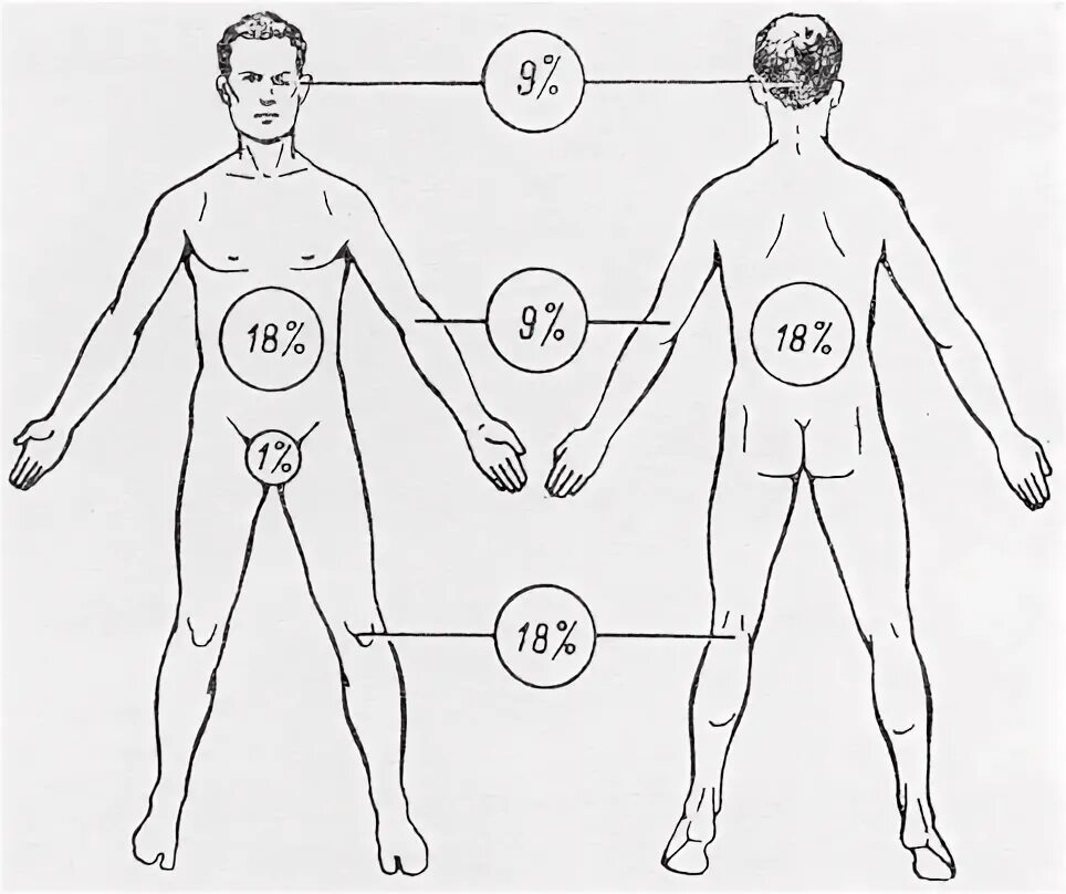 Правило 9 фото Передняя поверхность туловища по правилу девятки: найдено 89 изображений