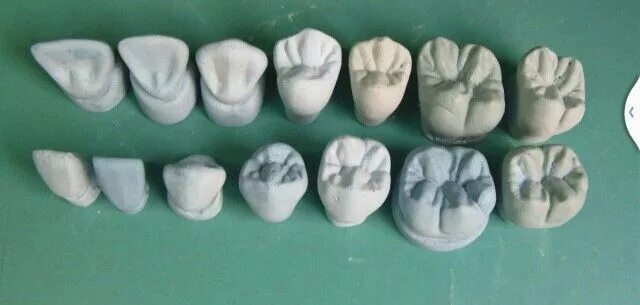 Премоляры верхней челюсти фото Piezas dentales Arte dental, Estetica dental, Laboratorio dental