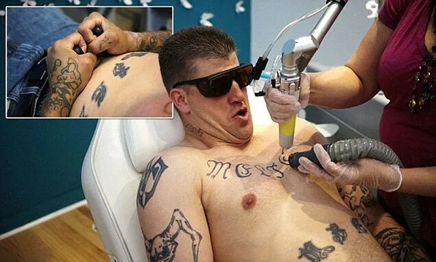 Преобразовать фото в тату Inside Colorado's 'What Were You Inking?' tattoo removal clinic for ex-cons