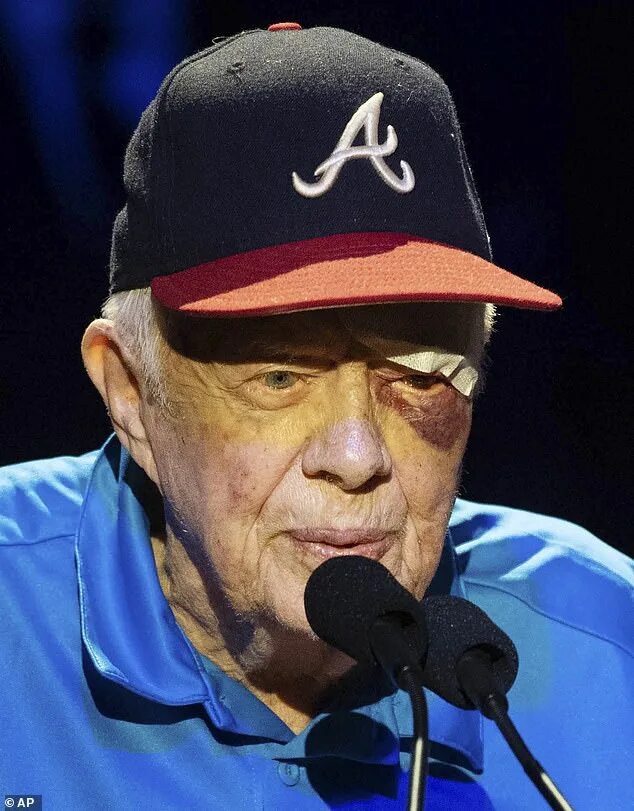 Президент картер сейчас фото PICTURED: Jimmy Carter, 95, sports black eye after falling for the second time i