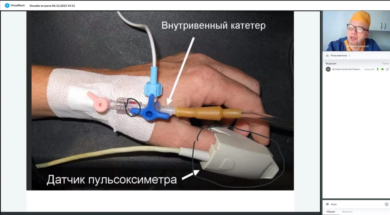 При подключении инфузионной системы к пвк необходимо Дополнительное образование медицинское обучение Медицинские курсы