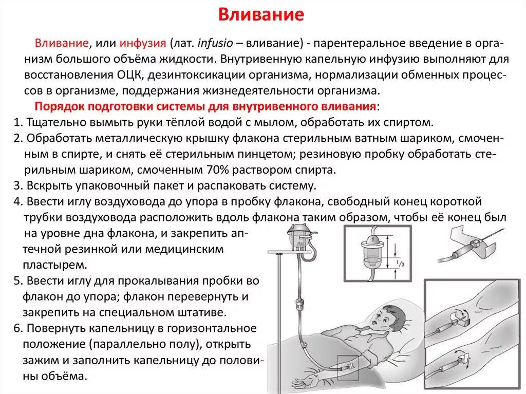 При подключении инфузионной системы к пвк необходимо Пошаговая инструкция капельницы: найдено 78 изображений