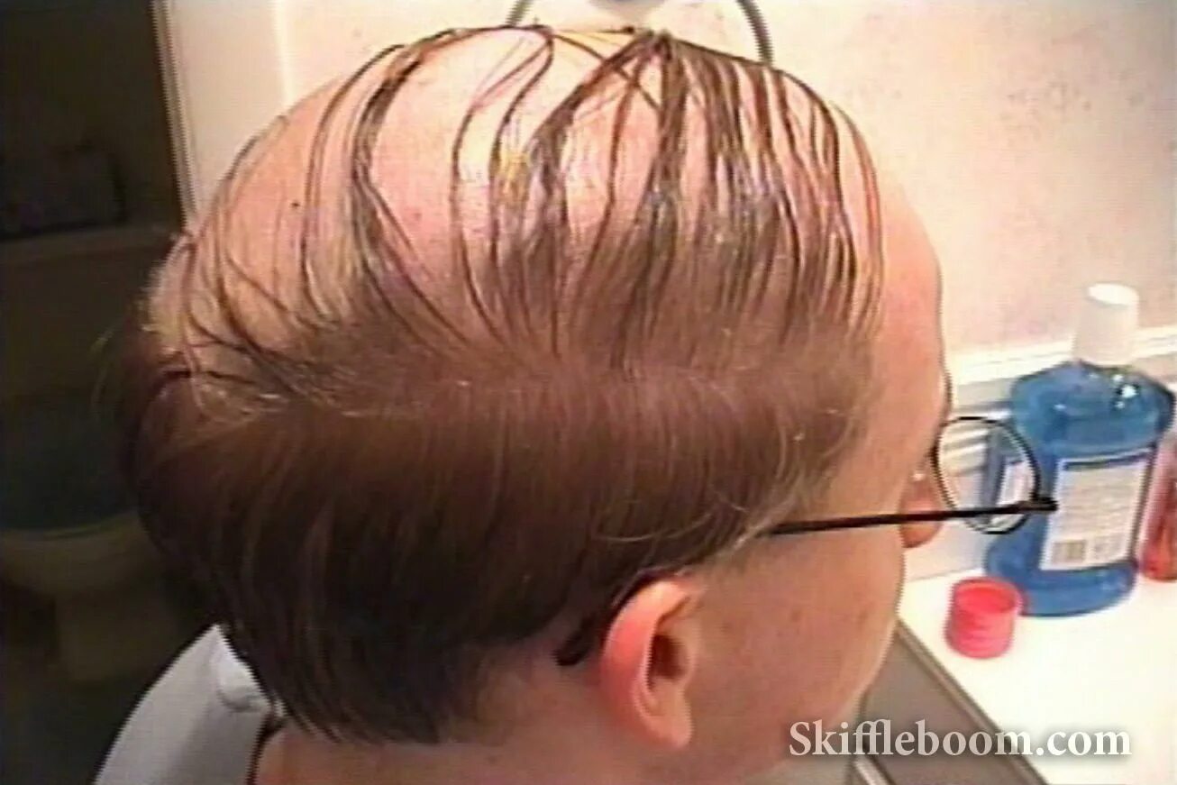 Прическа озеро в лесу мужская фото The COMBOVER: How to Buy Beer" - Skiffleboom.com Comb over, Cool hairstyles, Hai