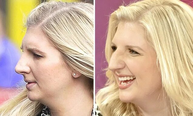 Прическа скрывающая длинный нос Rebecca Adlington reported to have had cosmetic surgery on her nose