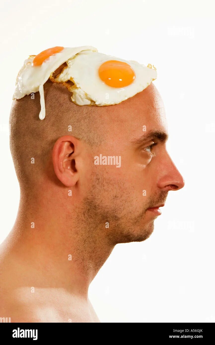 Прическа яйцо мужская Man with fried egg on head Stock Photo - Alamy