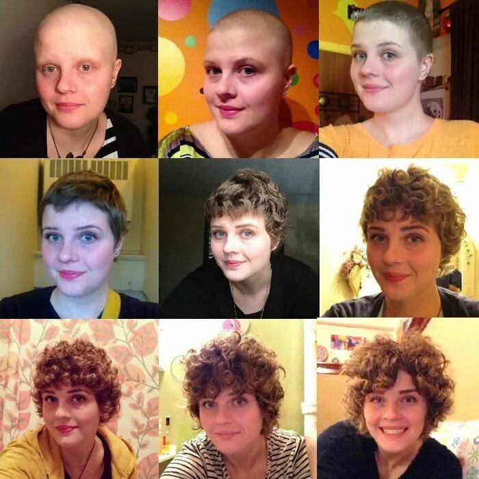 Прически после химиотерапии для женщин 1 year Chemo journey! - Awesome Hair growth after chemo, Growing hair after chem