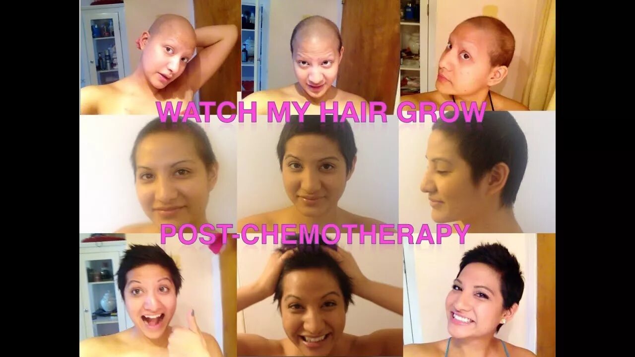 Прически после химиотерапии для женщин Hairgrowth Post-Chemotherapy Young women with Breast Cancer - YouTube