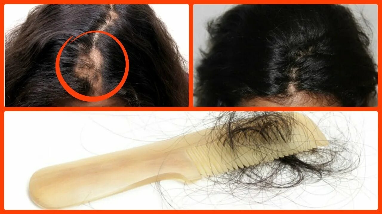 Прически растут волосы How to Stop Hair Fall & Get Faster Hair Growth/get long thick healthy hair/3 bes