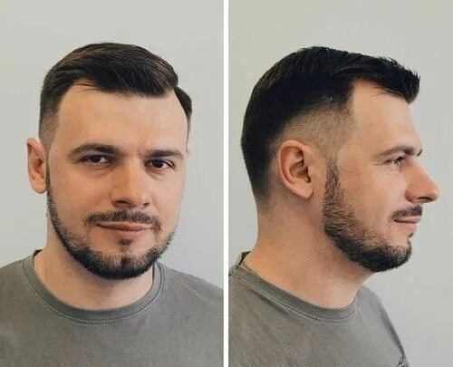 Прически с залысинами женские Access denied Haircuts for balding men, Balding mens hairstyles, Mens haircuts f